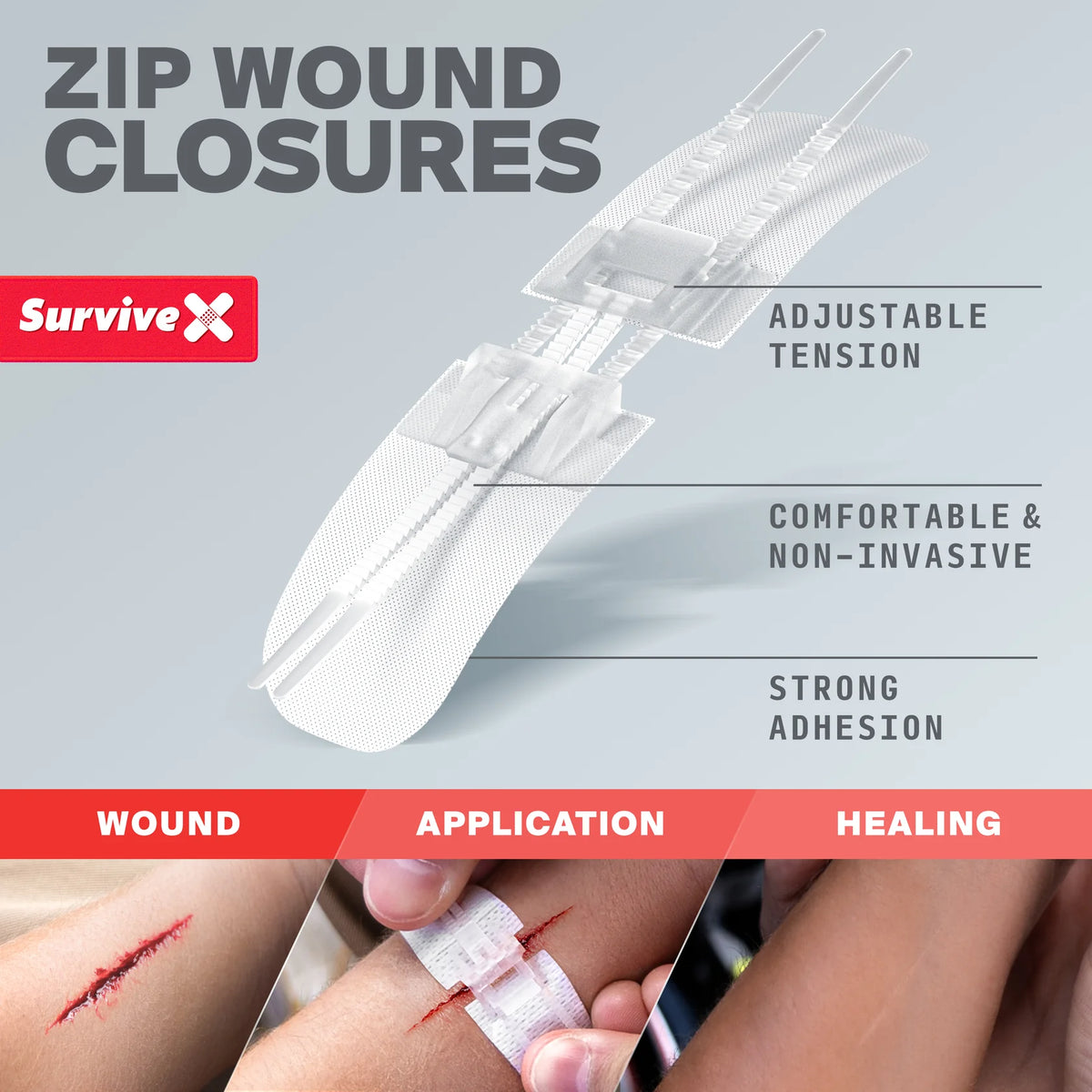 Survive X Zip Stitch Wound Closures